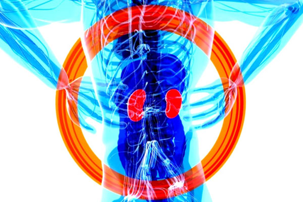 Woman’s kidney infection due to improper use of antibiotics